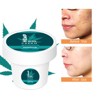 Hemp  Anti Aging Face Cream Acne Treatment Anti Wrinkle Shrink Pores Remove Pigmentation Smooth Fine LinesBody Face Care 40g